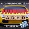 Is Automotive ADHD Real? 341