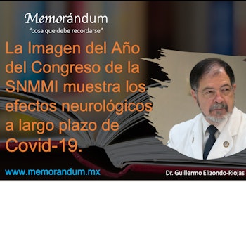 La Imagen del Año del Congreso de la SNMMI muestra los efectos neurológicos a largo plazo de Covid-19.