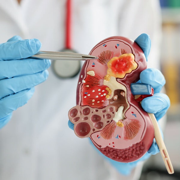 Audio Article: The Oral Health Connection to Chronic Kidney Disease