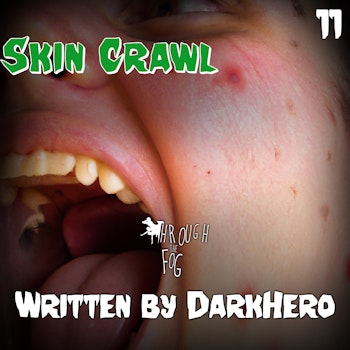 Skin Crawl (31 Days of Horror Day 11)