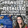 EP17 - Laura Duzett - Dyshidrotic Eczema & Just Released: The Low-Nickel Diet Cookbook