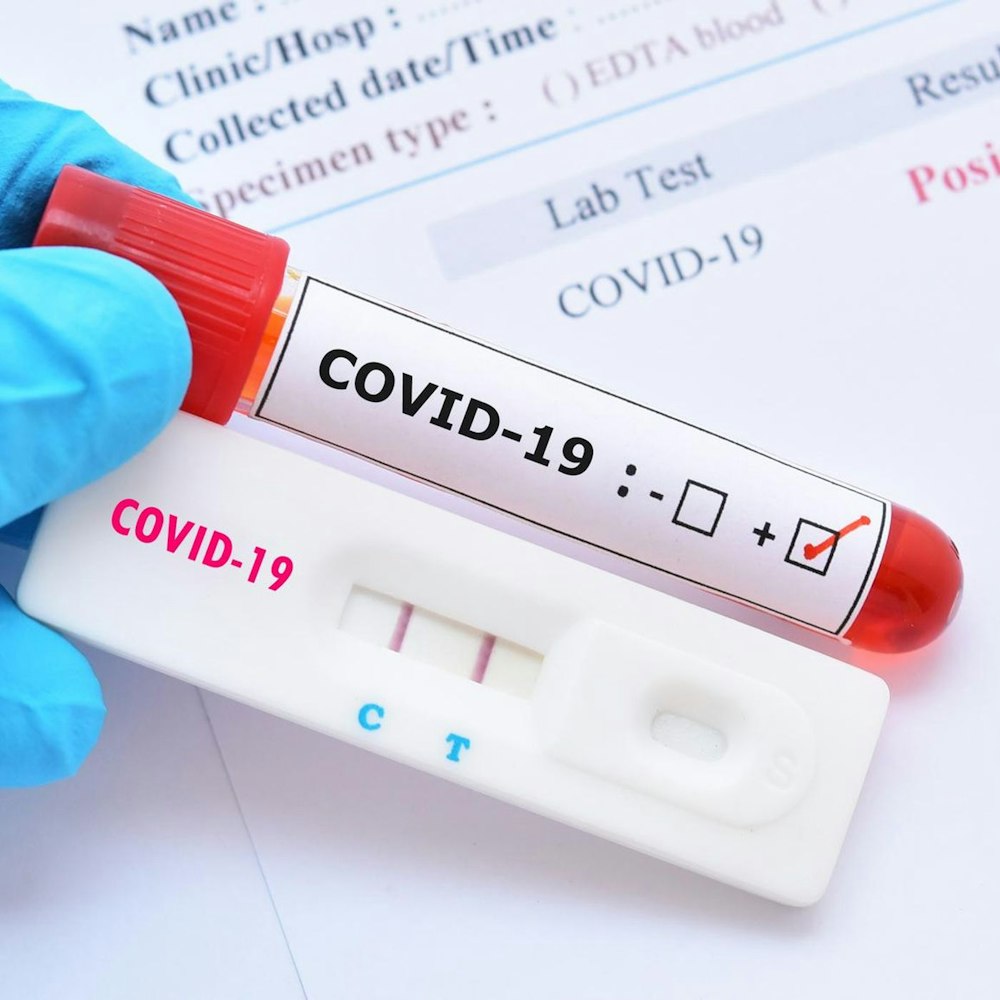 My Daughter Tested Postive for Covid-19