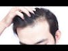 Natural Solution for Hair Loss with Mahryah Shain