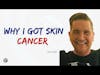 Skin Cancer - Zak Szabo
