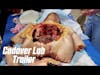 TRC1 Cadaver Lab Trailer 4K