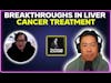 Breakthroughs in liver cancer treatment