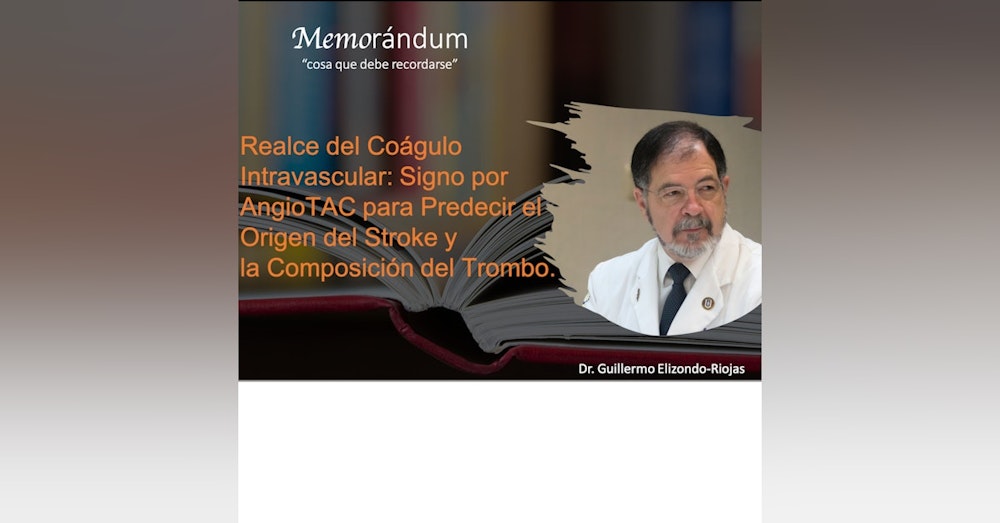 Realce del Coágulo Intravascular: Signo por AngioTAC para Predecir el Origen del Stroke y la Composición del Trombo.
