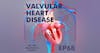 Valvular Heart Disease with Tim Madeira, DNP