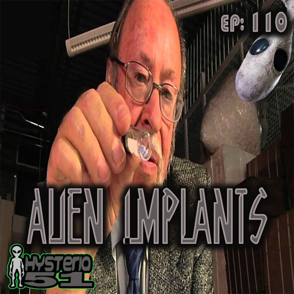 Alien Implants | 110