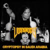 Cryptopsy in Saudi Arabia