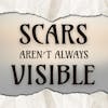 Scars Are Not Always Visible