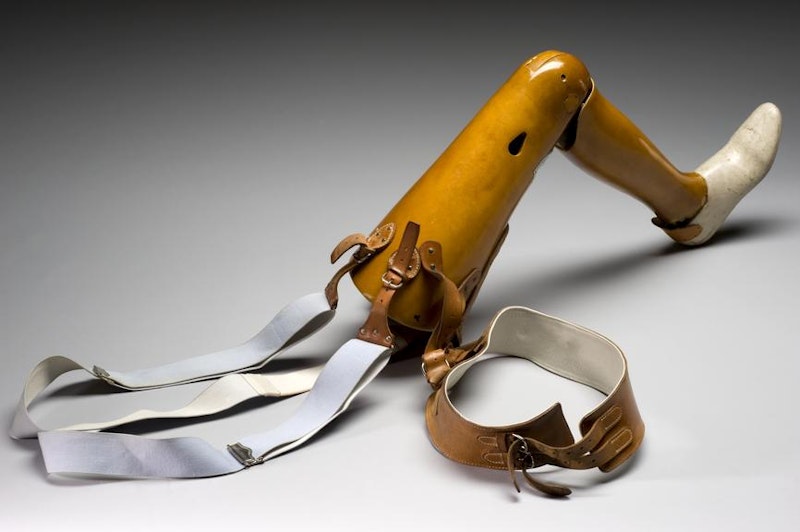 What is the History of Prosthetics?