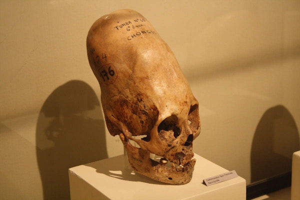 Enlongated Skulls - Human or Alien?