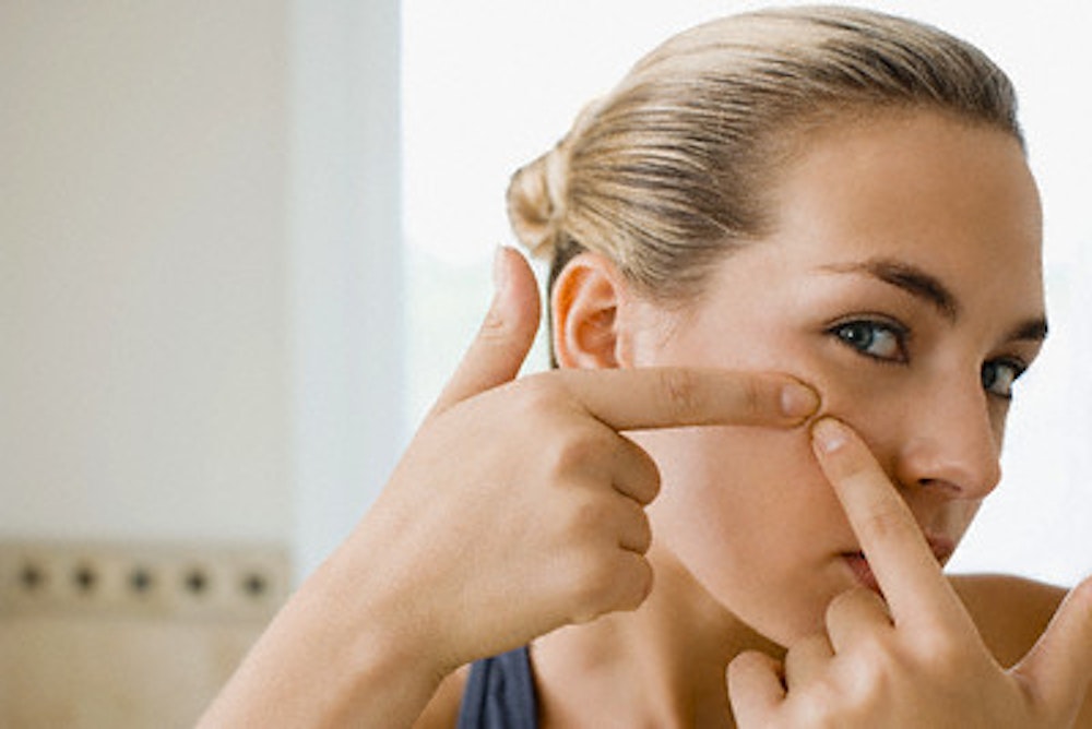 Acne Facts: The 6 basic principles of acne-prone skin