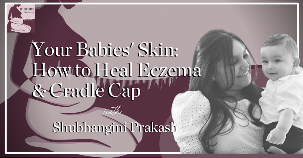 EP115- Your Babies' Skin: How to Heal Eczema & Cradle Cap with Shubhangini Prakash