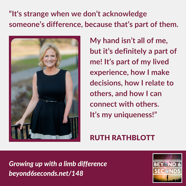 Limb difference, disability and workplace diversity – with Ruth Rathblott