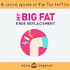 Episode 48: My Big Fat Knee Replacement