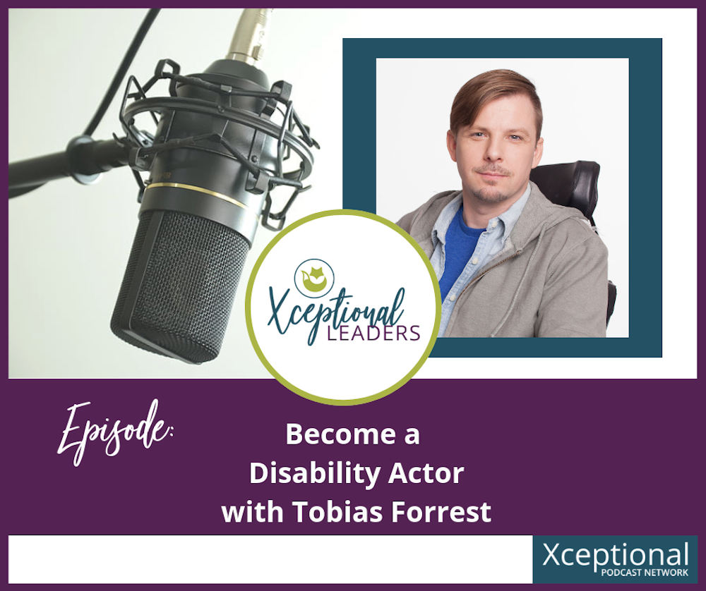 Become a Disability Actor with Tobias Forrest