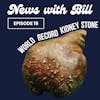 016: World Record Kidney Stone