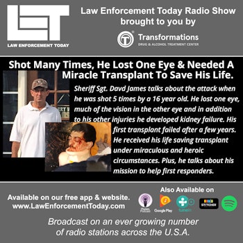 S3E46: Shot Many Times, He Lost An Eye And Needed A Miracle Transplant To Save His Life.
