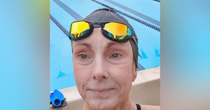 image for Swimming, Eczema, and the Hidden Dangers of Topical Steroids