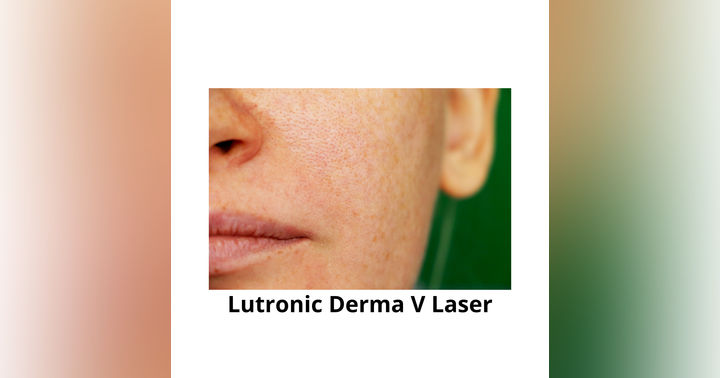image for Lutronic Derma V Laser Explained: Uses, Technology & Clinical Insight with Dr. James Wang